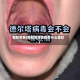 新冠变异(新冠变异毒株有什么症状)