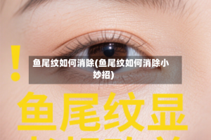 鱼尾纹如何消除(鱼尾纹如何消除小妙招)