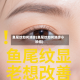 鱼尾纹如何消除(鱼尾纹如何消除小妙招)