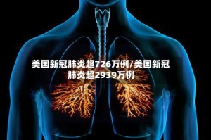 美国新冠肺炎超726万例/美国新冠肺炎超2939万例