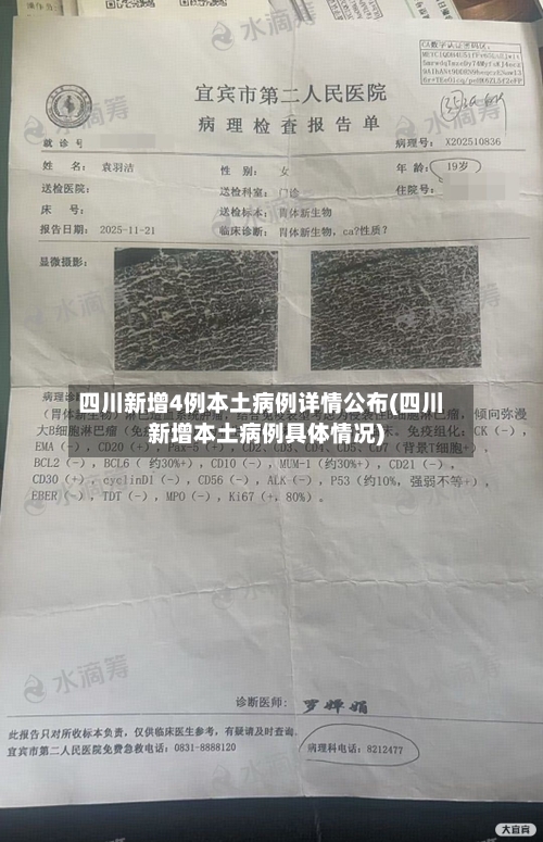 四川新增4例本土病例详情公布(四川新增本土病例具体情况)-第2张图片