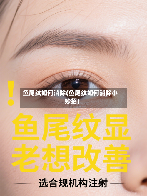 鱼尾纹如何消除(鱼尾纹如何消除小妙招)-第1张图片