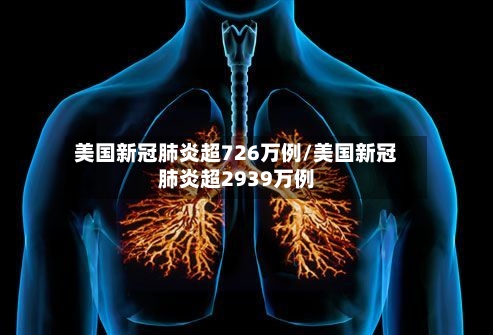美国新冠肺炎超726万例/美国新冠肺炎超2939万例-第1张图片