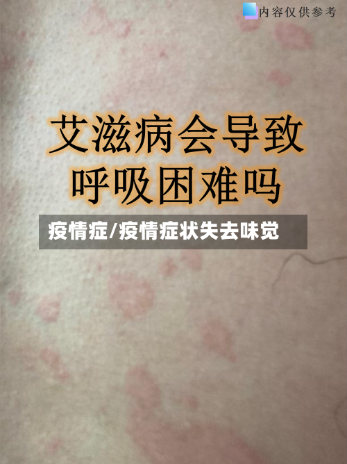 疫情症/疫情症状失去味觉-第1张图片